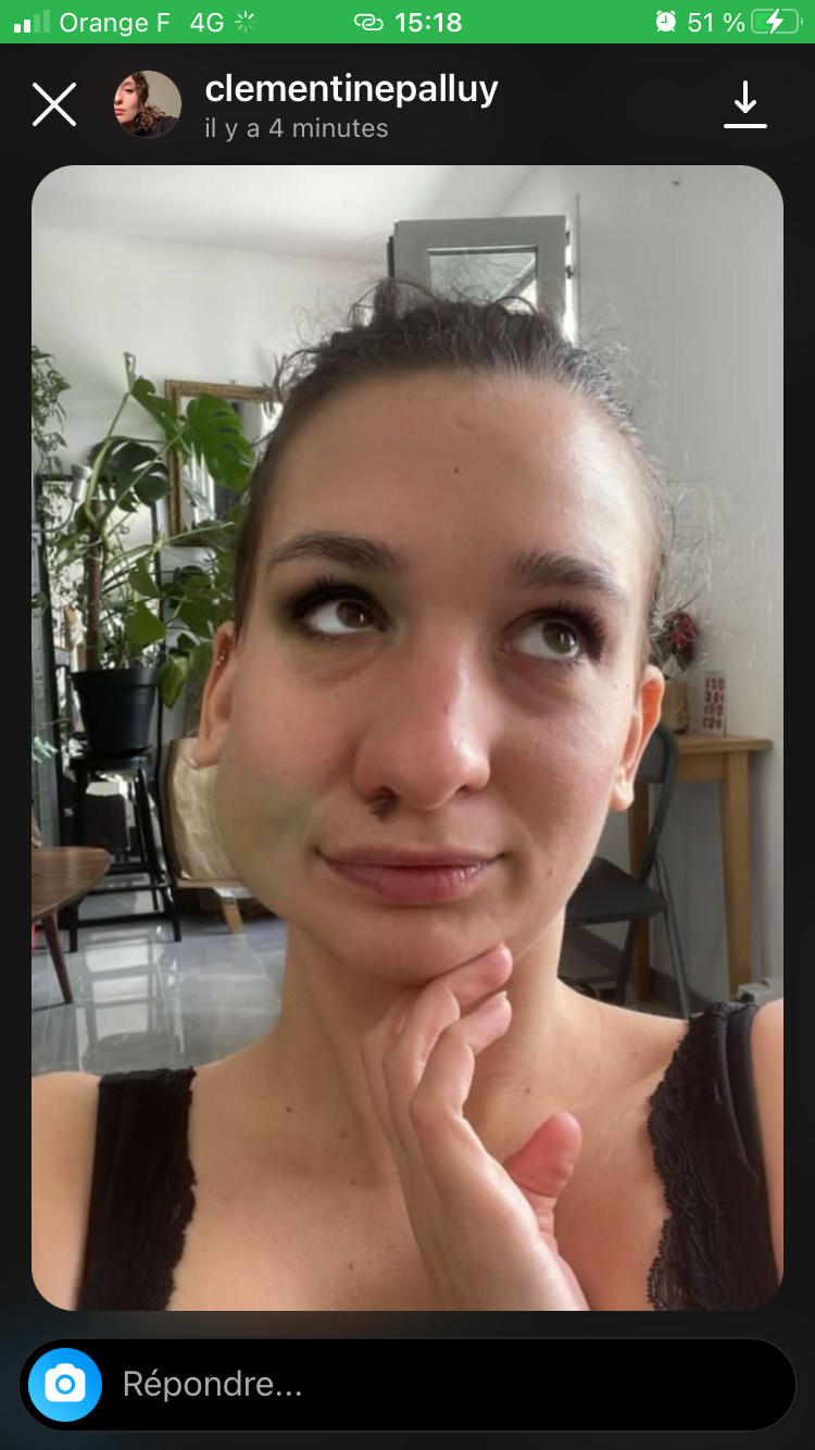 Une jeune femme se prends en selfie et tout le bas gauched e son visage est déformé et bleu. Sous son ney on devine du sang et des points de suture dessinés, un oeil au beurre noir apparait.