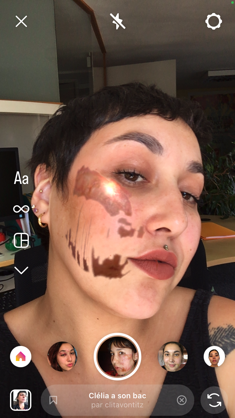 Une jeune femme se prends en selfie et on voit appraitre sur toute sa joue uen blessure brillante, ce qui a été suintant dans la vraie vie devient metallique sur Instagram.